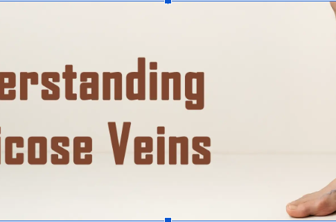 varicose veins specialist in Ahmedabad